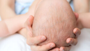 Read the statement from 31 worldwide organisations - 2 - Q KLINIK - Q KLINIK Close-up of a baby's bald head gently cradled in an adult's hands